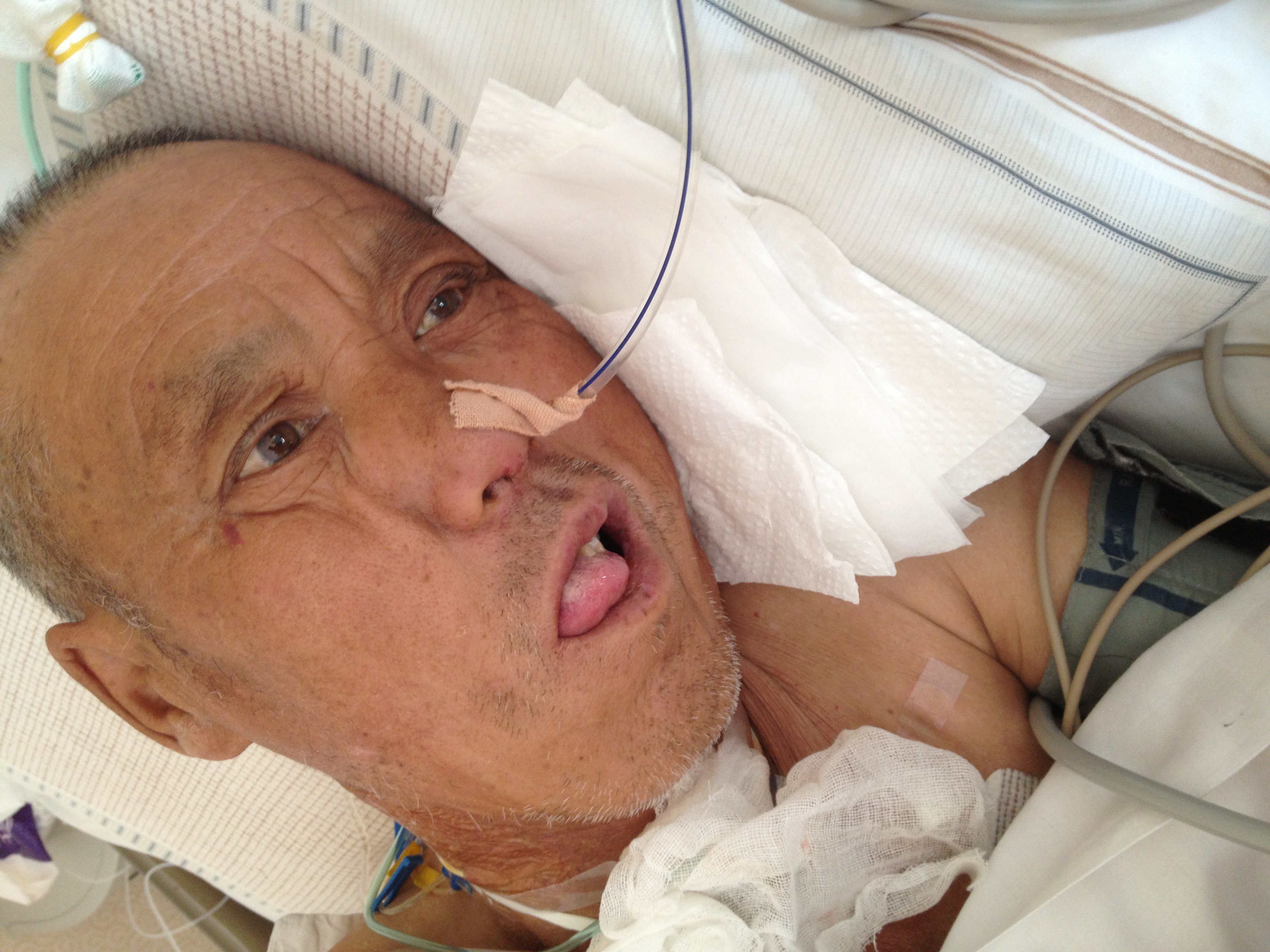 按照医生要求伸舌