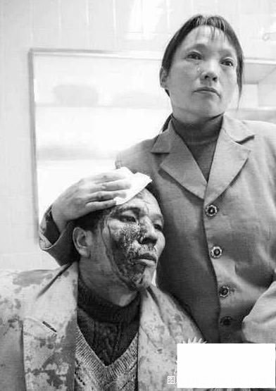 想要回一年工钱的被打民工夫妻